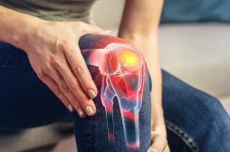 Arthrose du genou : un test sanguin peut détecter la maladie avant les radios