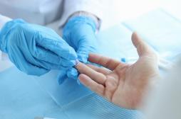 VIH : des cas de plus en plus fréquents chez les jeunes de 15 à 24 ans