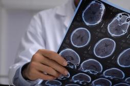 Traumatisme crânien : des implants cérébraux ont aidé 5 personnes à se rétablir