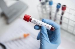 Papillomavirus : près d’un tiers des hommes dans le monde sont touchés 