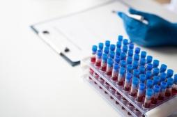 Alzheimer : la maladie rénale peut fausser le résultat du dépistage