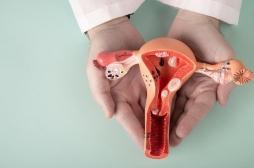 Cancer du col de l’utérus : les femmes handicapées sont moins susceptibles de subir un dépistage