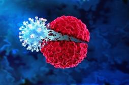 Cancer du sein triple négatif : résultats prometteurs pour un traitement par virus oncolytique