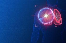 Cancer : l’IA peut-elle aider à vaincre les tumeurs 