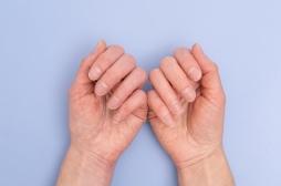 Cancer de la peau : comment détecter un mélanome sur vos ongles
