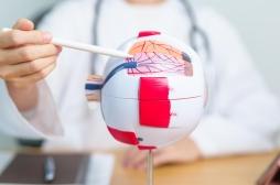 Un implant placé dans la rétine permet d’améliorer la vue des personnes atteintes de DMLA 