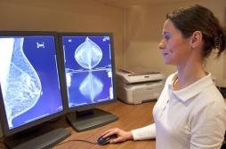 Prothèses mammaires et cancer : toutes les questions que se posent  les femmes 