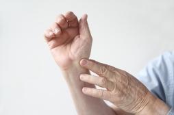 Arthrose de la main : un médicament courant pourrait atténuer les symptômes 