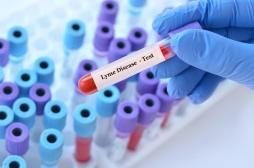 Maladie de Lyme : vers un meilleur diagnostic ? 