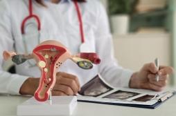 Prise en charge de l’endométriose : comment faire mieux ? 
