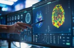 Cancer du poumon : cette empreinte cérébrale peut prédire les chances de survie