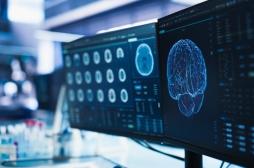 Delirium : une confusion lors d'une hospitalisation doit-elle inquiéter ?