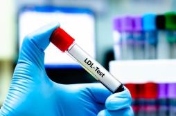Cholestérol : le test classique est-il assez précis ?