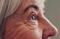 Alzheimer : et si cette bactérie de l'œil était en cause ?