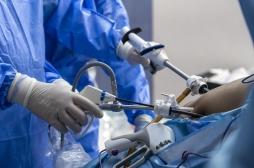 Obésité : une récente technique chirurgicale plus efficace que le Bypass