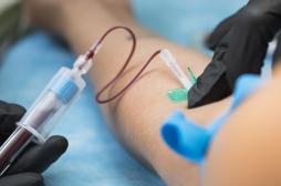 Maladie hépatique : un simple test sanguin peut prédire le risque