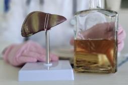 Hépatite alcoolique : le décès d'un parent par maladie hépatique double le risque 