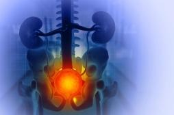 Traitement de l’hypertrophie de la prostate : un hôpital de l’Eure innove avec de la vapeur d’eau