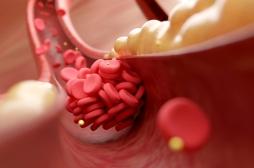 Cholestérol : une nouvelle pilule pour le traiter 