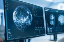 Douleur chronique : des ultrasons pour la traiter sans médicament ?
