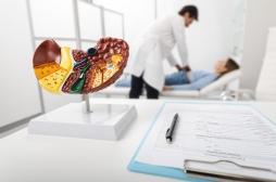 Foie : ce type de régime favorise le développement des cellules cancéreuses