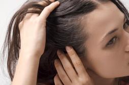 À la racine des cheveux, il passe inaperçu : ce champignon se propage dans les hôpitaux