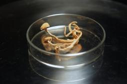 Dépression : une substance issue des champignons hallucinogènes pourrait soulager les symptômes