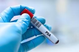 Dépistage du cancer de la prostate : une baisse des décès enfin confirmée ?