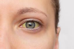 Cancer du pancréas : ce signe n'est pas forcément un symptôme de la maladie