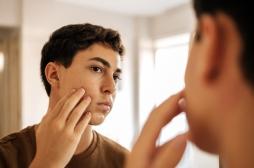 Looksmaxxing : jusqu'où certains jeunes sont-ils prêts à aller pour séduire ?