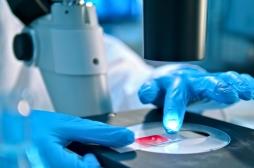 Traitement de la leucémie : la piste des combinaisons de médicaments