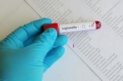 Légionellose en Suisse : quelle est l’origine de la contamination ?
