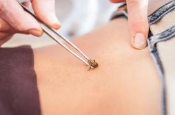 Maladie de Lyme : elle se fait piquer par des abeilles puis voit ses symptômes disparaître