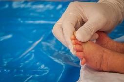 Une mutation génétique fait apparaître un sixième doigt chez les bébés