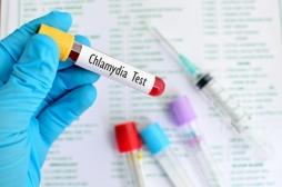Chlamydia : un dépistage systématique de la MST recommandé pour les jeunes femmes
