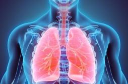 Le cancer du poumon au stade avancé pourrait se passer de la chimiothérapie