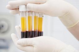 Covid-19 : le plasma masculin produit plus d’anticorps que celui des femmes