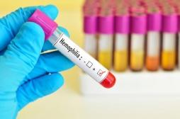 Hémophilie B : une seule injection peut traiter la maladie à vie