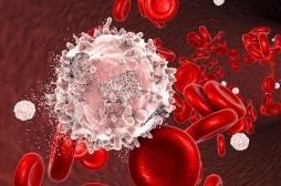 Leucémie aiguë myéloïde : l’analyse des cellules souches permet de transformer le traitement