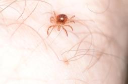 Un premier décès lié à une allergie à la viande causée par les tiques