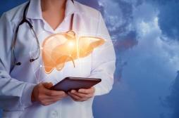 Cancer du foie : l'IA dispense d’examens compliqués pour prédire vos risques 