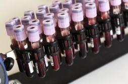 Cancer du sang : un traitement révolutionnaire au CHU de Rennes