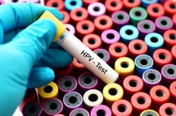 Papillomavirus : pourquoi les jeunes garçons doivent aussi se faire vacciner 