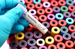 La thérapie génique, un nouveau traitement de l’hémophilie ?