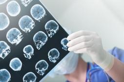 Maladie de Parkinson : un implant cérébral auto-adaptatif pourrait aider les patients