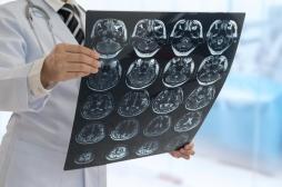 Les commotions ont un impact durable sur l’activité cérébrale des jeunes adultes