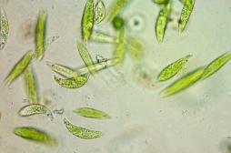 Blessure : cette algue peut aider la chair à cicatriser plus vite 