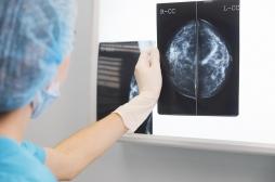 Cancer du sein héréditaire : le dépistage par IRM est plus efficace que la mammographie