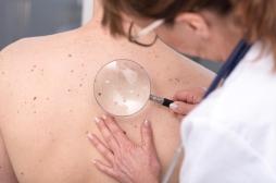 Pénurie des dermatologues : la moitié des patients français renonce à consulter 