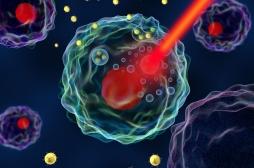 Cancer du pancréas : une administration des traitements par nanoparticules est prometteuse